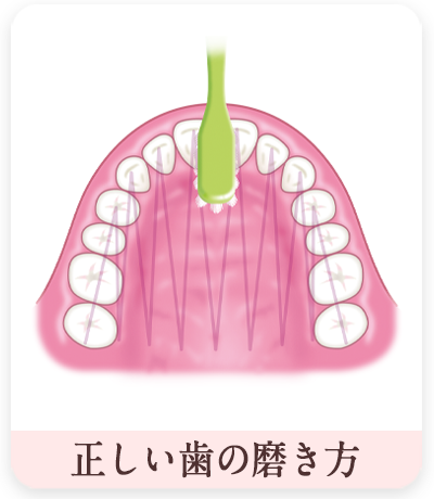 正しい歯の磨き方　フォーンズ報上あご）イラスト